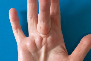 Mâna albă întinsă plată, cu degetul mijlociu lipit în sus ușor și o creastă ridicată de-a lungul palmei