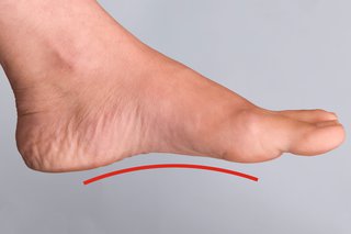 Piciorul stâng al unei femei cu o arcuire ridicată (arc) vizibil de-a lungul părții inferioare a piciorului