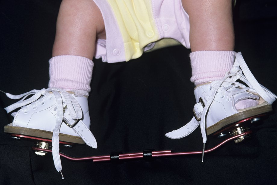 Picioarele copilului cu cizmele lipite de bară